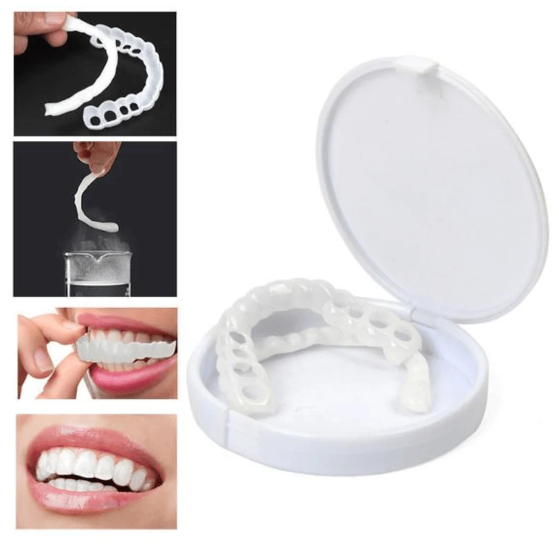 Perfect Smile Snap On Braces