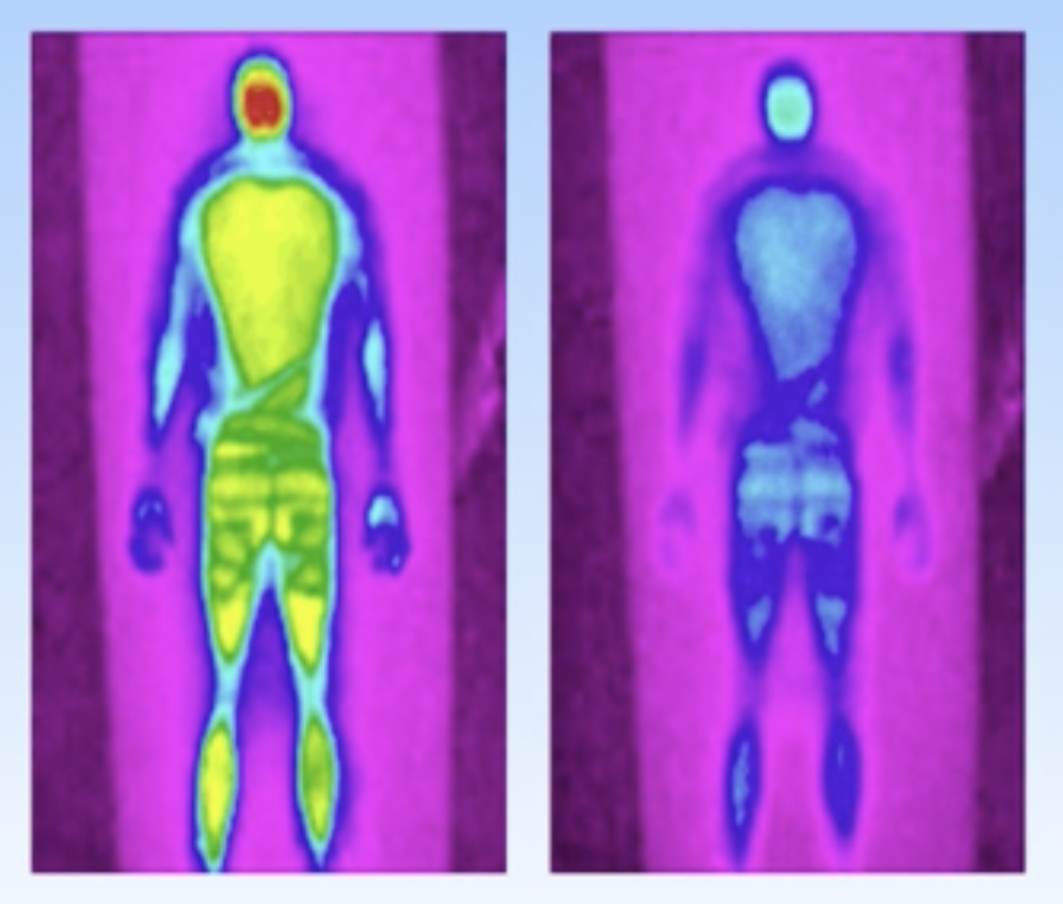 Simbatex Foam Technology