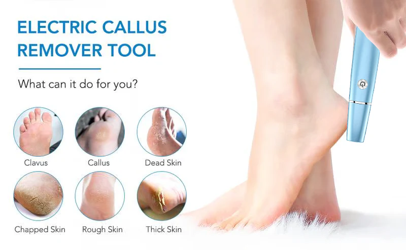 🔥Electric Feet Callus Remover⚡