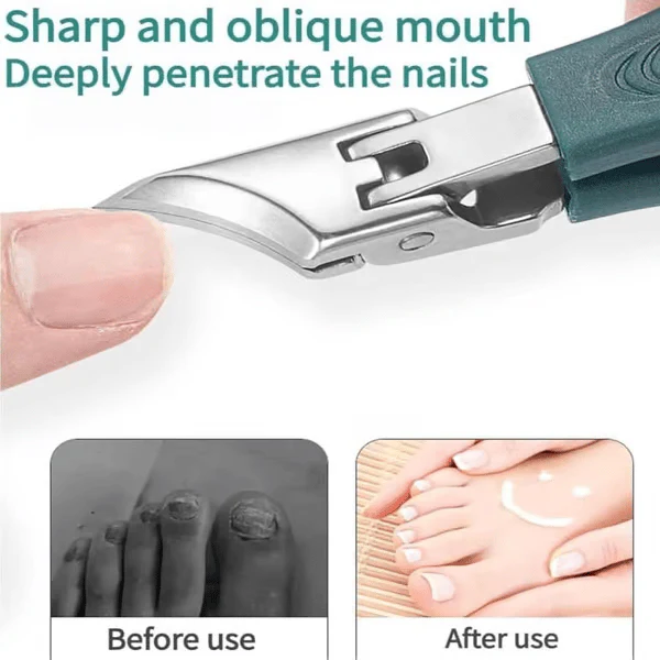 ⏳ Limited time 50% discount💥 von Podologist Recommended nail clipper - ergonomic, angled design for toenails and ingrown nails