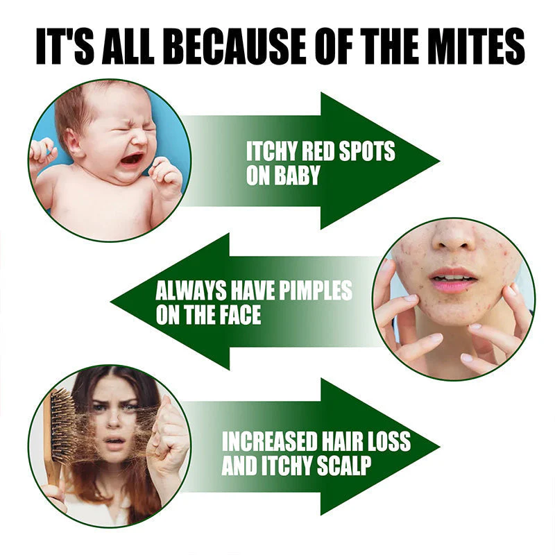 🎉Spring Specials🎉Powerful Mite Remover Spray - Deep Clean, Protect Health!