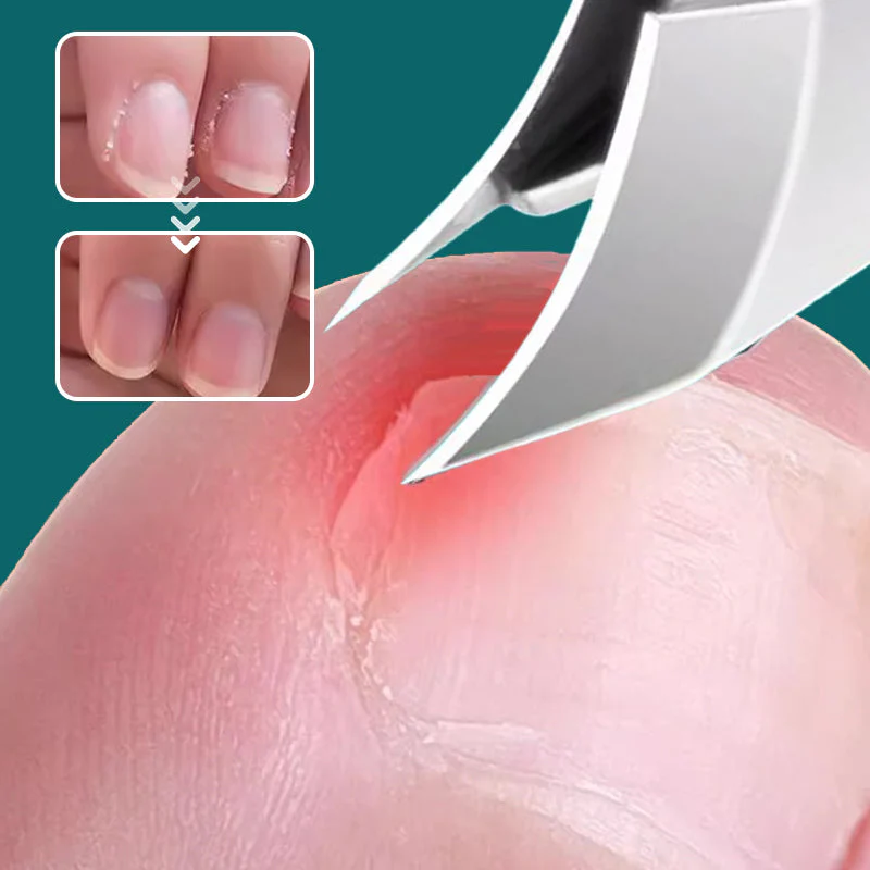 🔥 Splashproof 25° Beveled Edge Nail Clippers 3-Piece Set