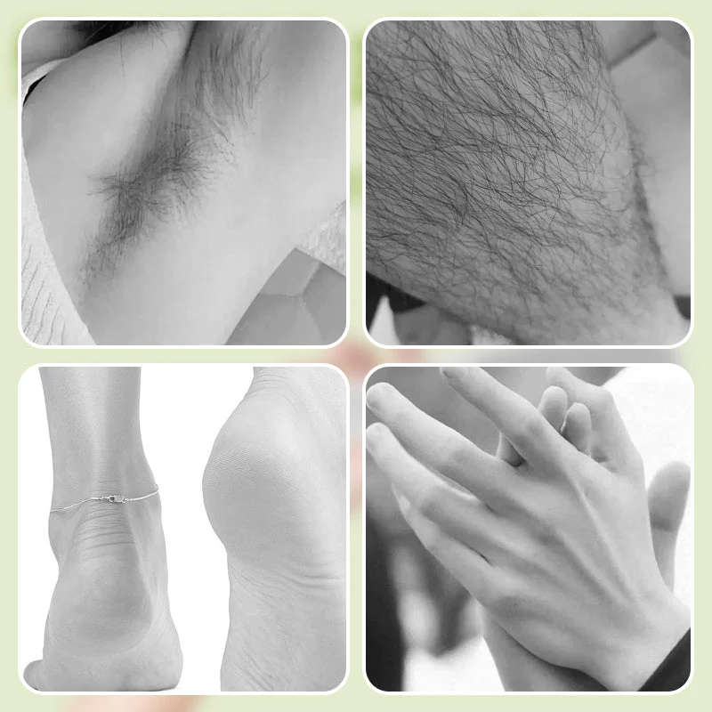 🔥2-in-1 Electric Foot Callus & Hair Remover