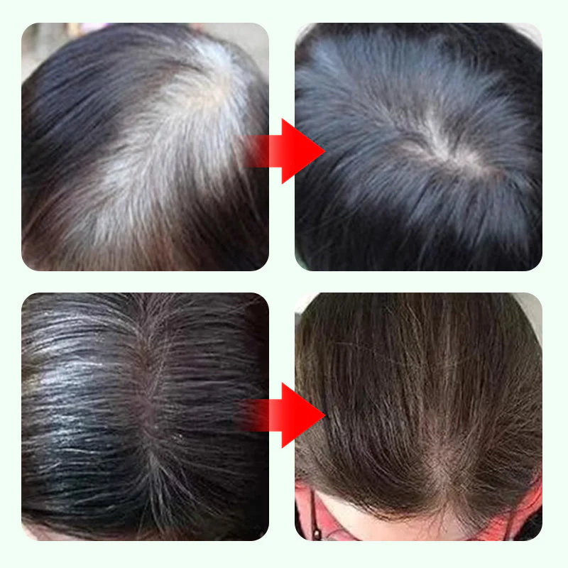 💇‍♀️3-color set meal✨ 10-Second Root Rescue! Gray Coverage Hair Pen - Instant Youth in a Click! ✨