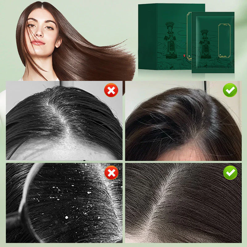 Herbal Anti-Dandruff & Oil-Control Shampoo Powder